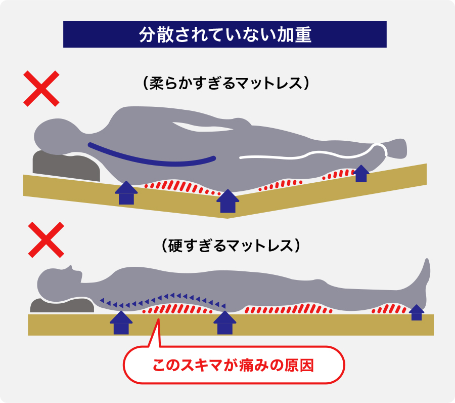 分散されていない加重の図